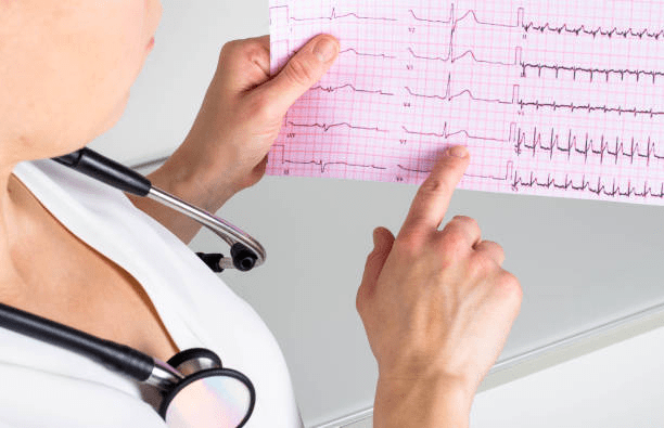 eletrocardiograma