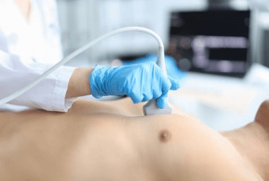 ecocardiograma